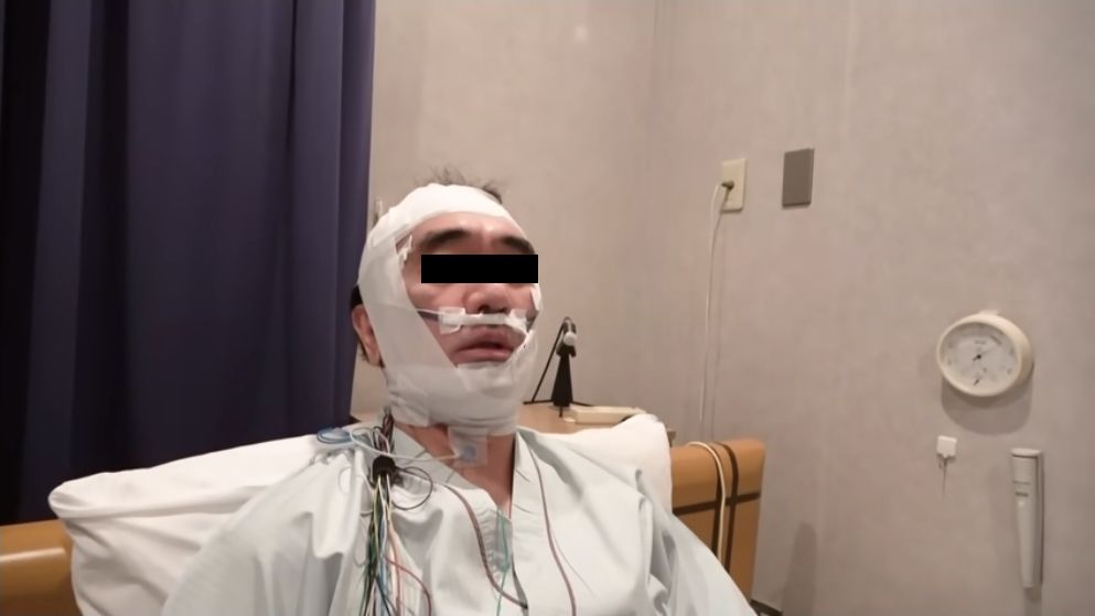 睡眠時無呼吸症候群で入院したときのイメージ画像