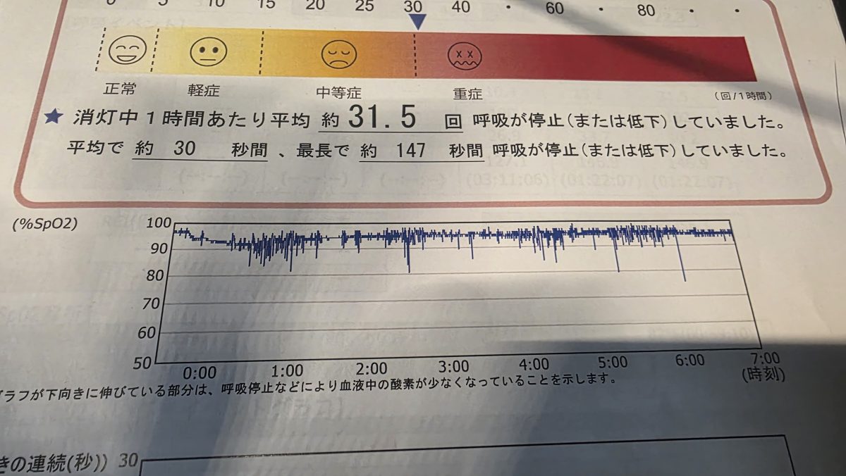 睡眠時無呼吸症候群簡易検査の結果